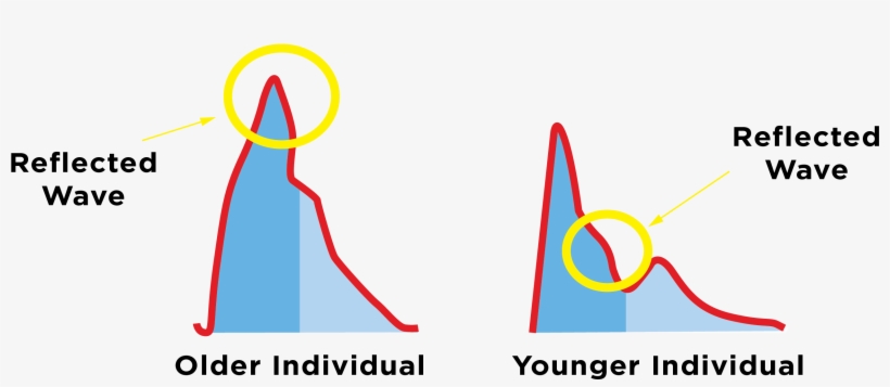 Pulse Wave Velocity Explained - Reflected Wave Heart, transparent png #6146872