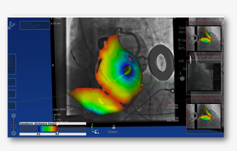 Turning The Bags Of Numbers Coming From Measurements - Portable Network Graphics, transparent png #6246190