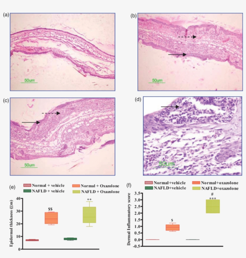 Effect Of Oxazolone On Ear Histopathology In Normal - Mouse Ear Inflammation Histo, transparent png #6258567