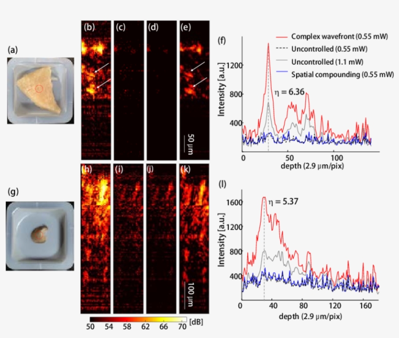 In Vitro Ws Oct Images Of The Chicken Breast And Mouse - Portable Network Graphics, transparent png #6258694