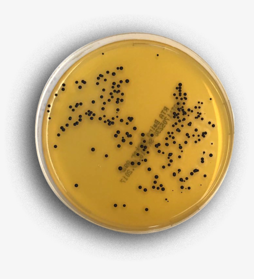 Baird Parker Agar - Baird-parker Agar, transparent png #6261731