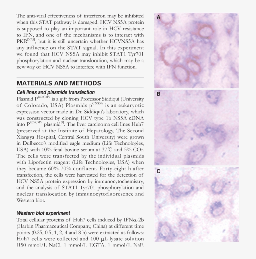 Hcv Ns5a Protein Staining Of Huh7 Cells After 48 H - Document, transparent png #6324655