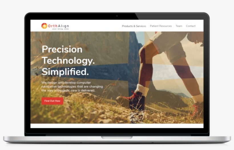 Knee Surgery Gets A Facelift - Apple Macbook Pro, transparent png #6326732