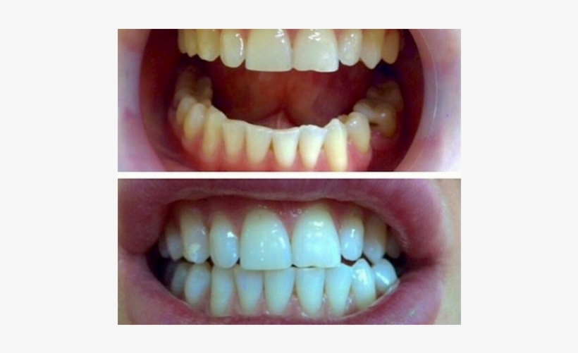 Everyone Feels Better When They Have Great Looking - Tongue, transparent png #6333966