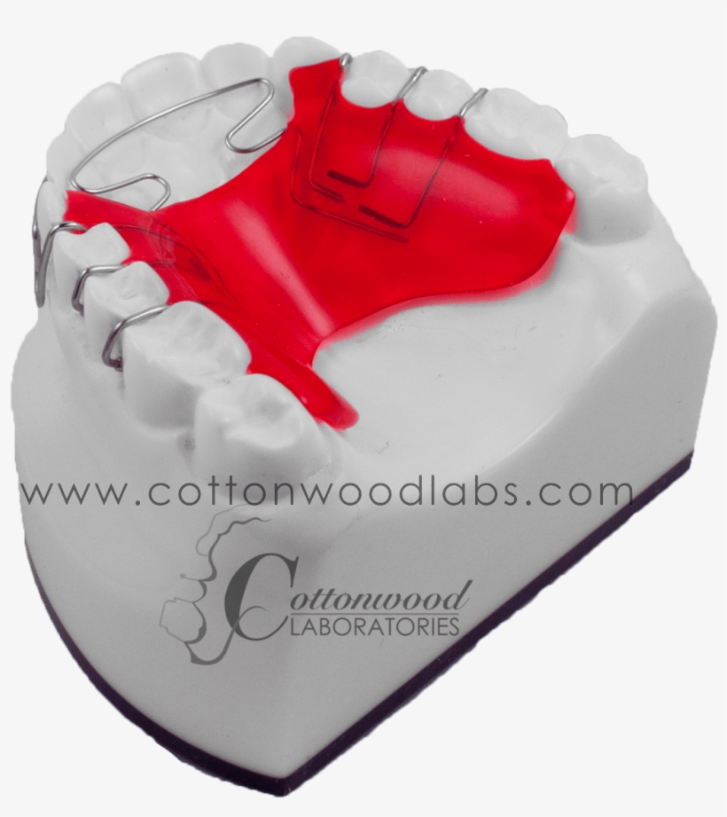 More Control Over Anterior Wire That Contacts The Teeth, - Birthday Cake, transparent png #6382415