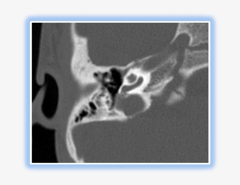 Slide0018 Image089 04 Nov 2009 - X-ray, transparent png #6398822