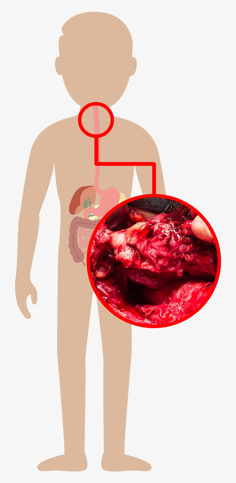 Mouth - Illustration, transparent png #6407724