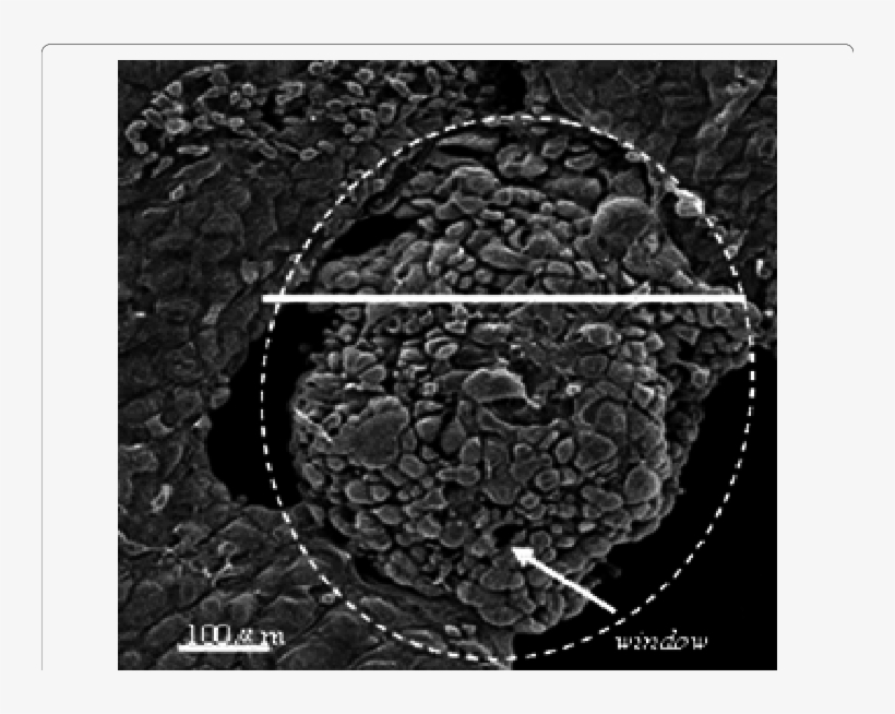 Omental Milky Spot On Greater Omentum Observed By Sem - Greater Omentum, transparent png #6434167