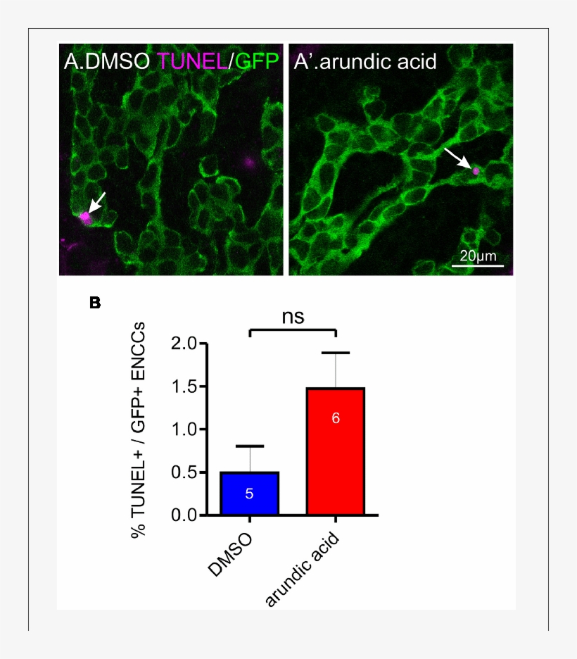 Effect Of Arundic Acid On Encc Cell Death In E13 - .org, transparent png #6453549