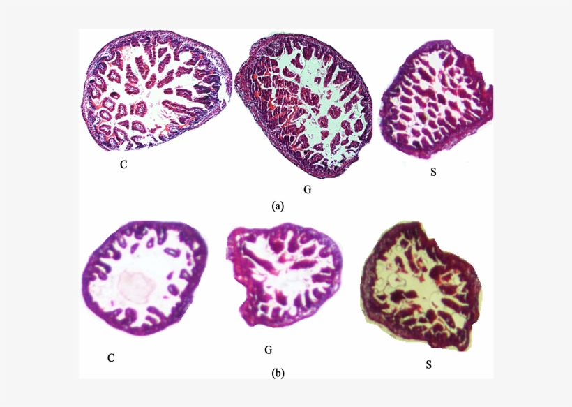 Photomicrography (100x) Of Intestines Of G 1 Rats - Large Intestine, transparent png #6462432