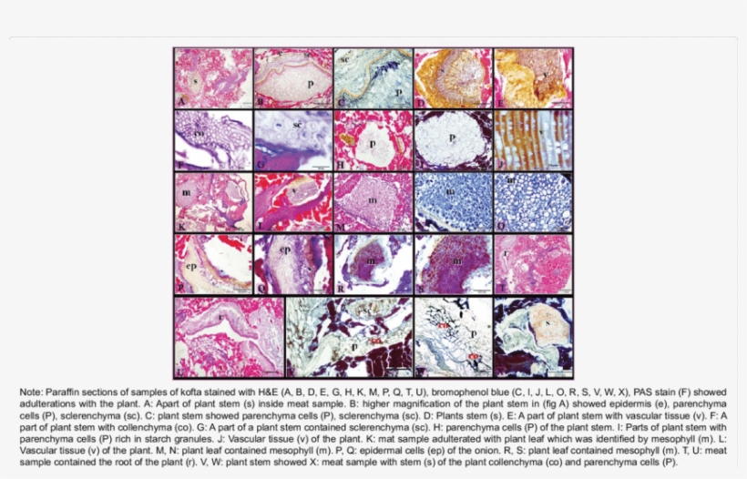 Adulterations Of Hawawshi Samples With Plant Tissues - Tissue, transparent png #6476760