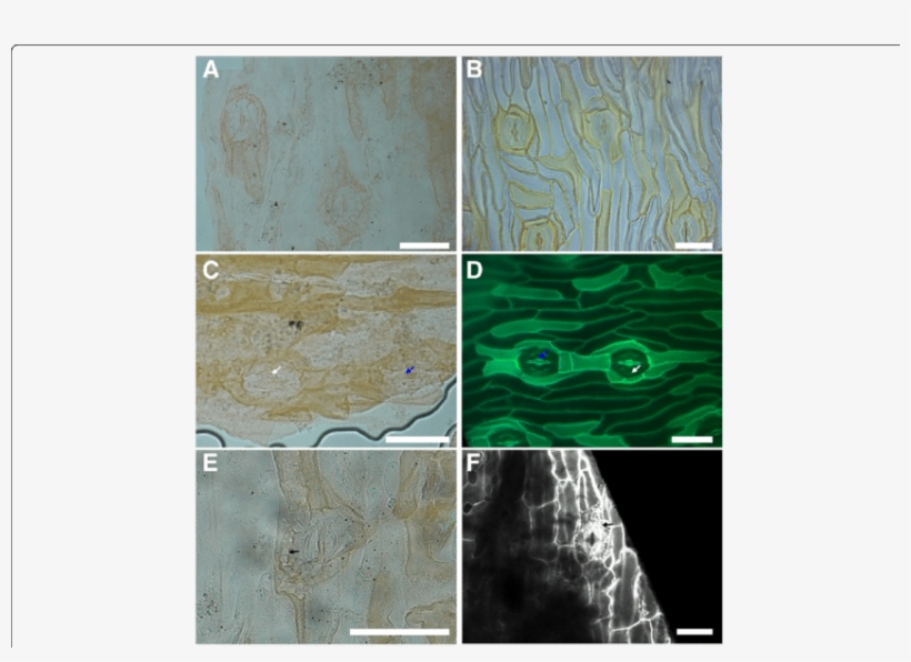 Comparison Between The Cuticle Of Eobowenia Incrassata - Pavement Cells, transparent png #6484318