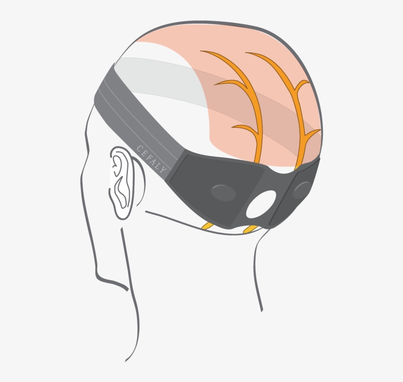 Occipital Neuralgia, transparent png #6578417