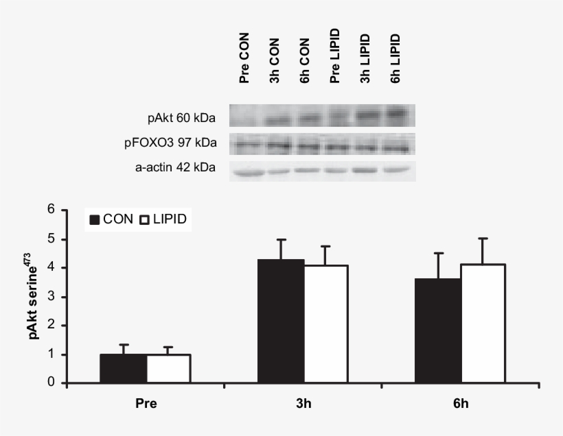 Skeletal Muscle Akt Serine 473 Phosphorylation During, transparent png #6588252