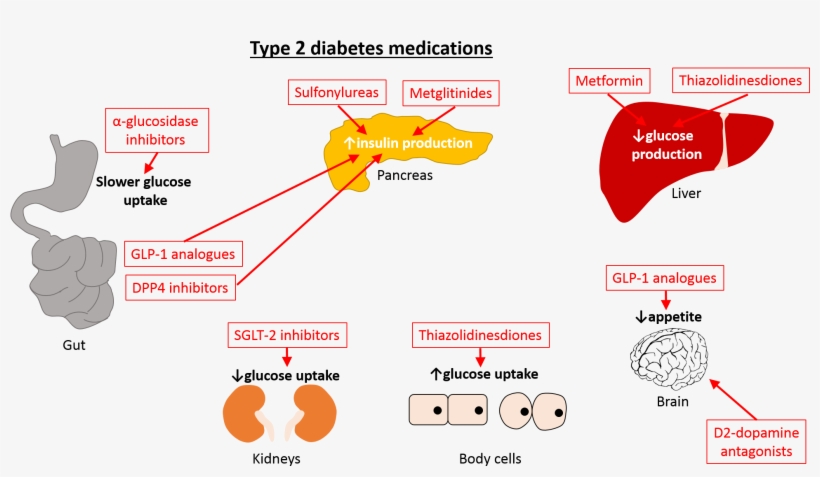 Metformin Is The Most Commonly Used Type Of Medication, transparent png #6593260