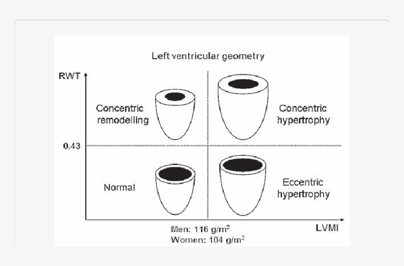 Left Ventricular Geometry Patterns, transparent png #6603192