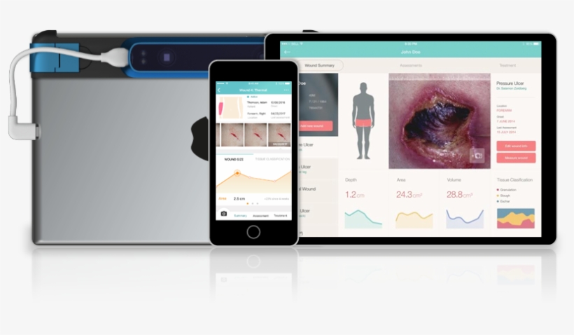 Wound Assessment Capability To You As A Simple Mobile, transparent png #6648169