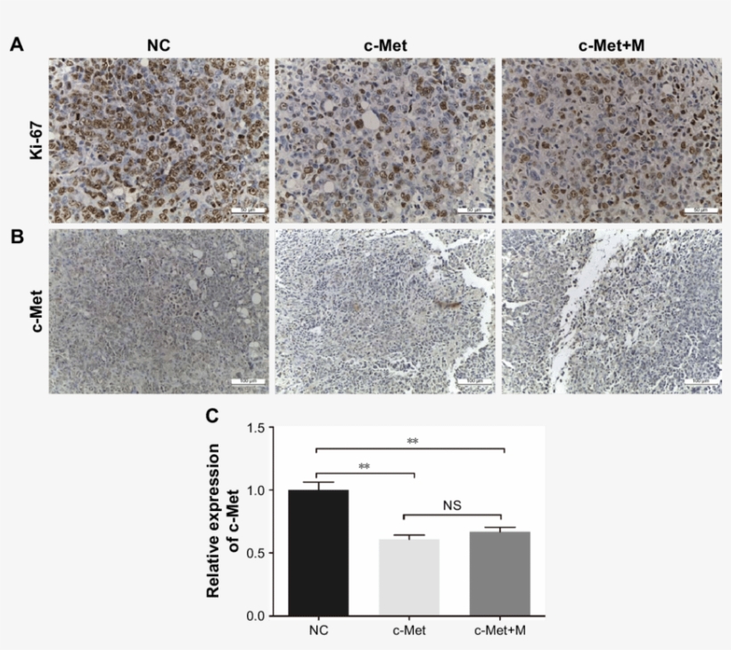 Histological Examination Of Ki, transparent png #6657089