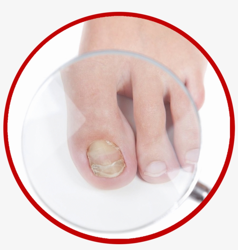 Fungus Png, transparent png #6673055