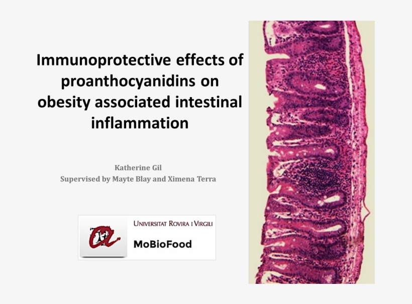 Immunoprotective Effects Of Proanthocyanidins On Obesity, transparent png #6685797
