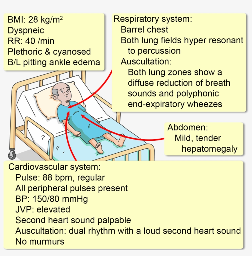 He Has Smoked For A Total Of 62 Pack Years, And Has, transparent png #6734692