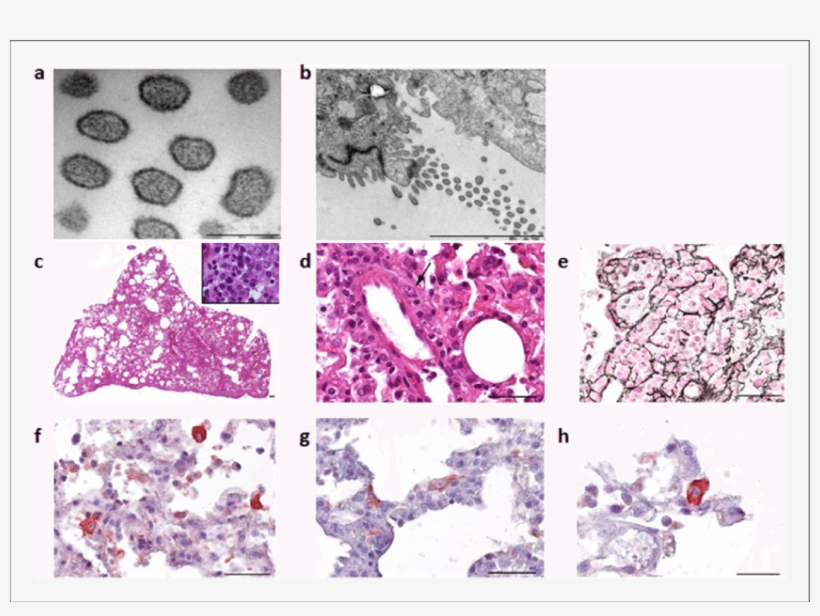 Electron Microscope Images Of The Cardamones Variant, transparent png #6734782