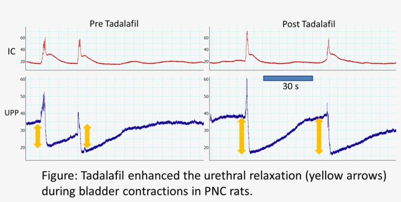 Source Of Funding, transparent png #6789219