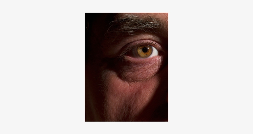 Dry Eyes - Close-up, transparent png #688517