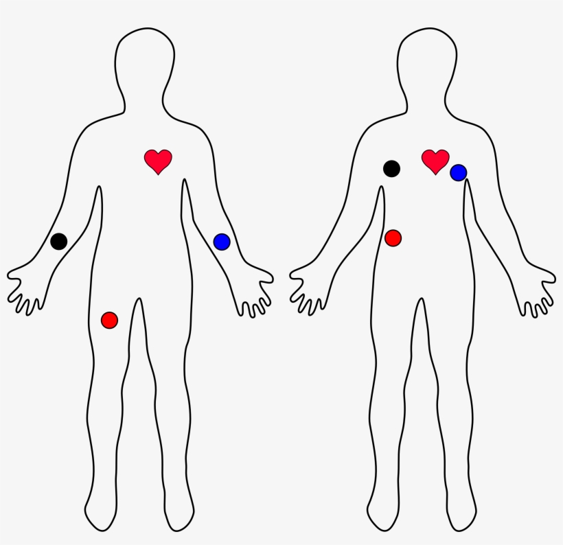 Nodeheart Part - Electrocardiography, transparent png #689949