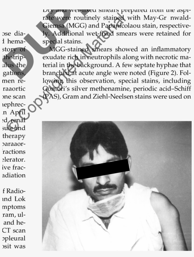 The Swelling Over The Upper Part Of The Left Arm, transparent png #6821123