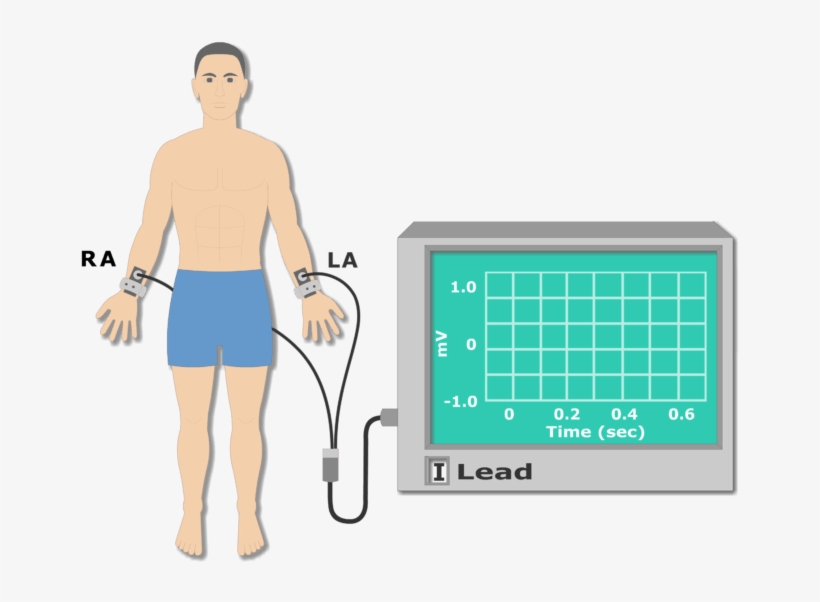 Left Arm Electrode Placement Animation Slide, transparent png #6821177