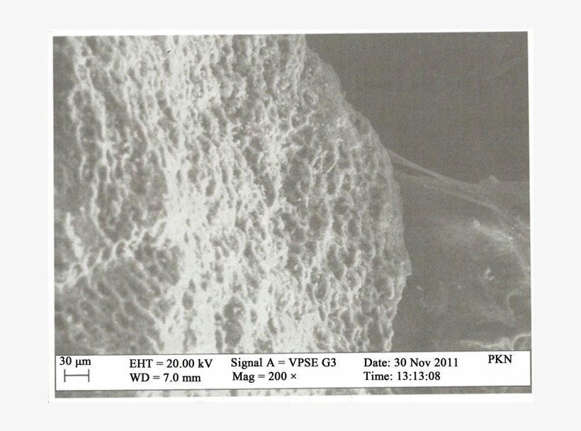 Pkn Before Adsorption, transparent png #6846113