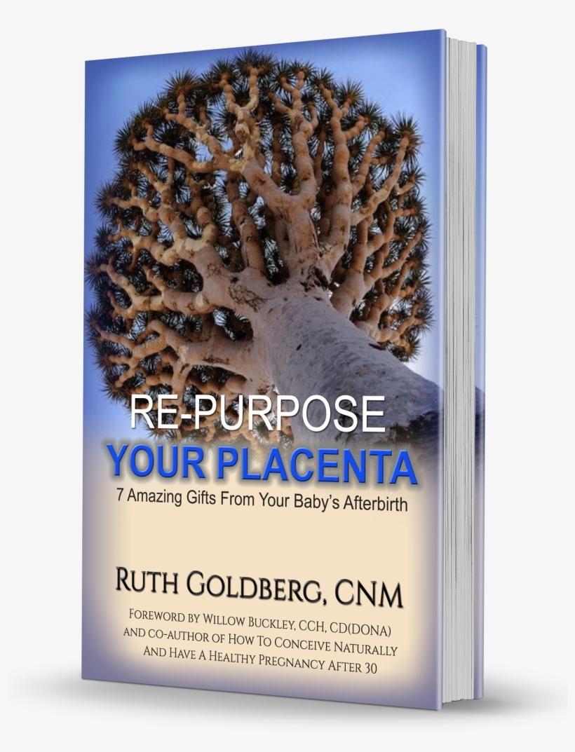Re-purpose Your Placenta , Association Of Placenta - Wollemi Pine Has Yellow Leaves, transparent png #690220