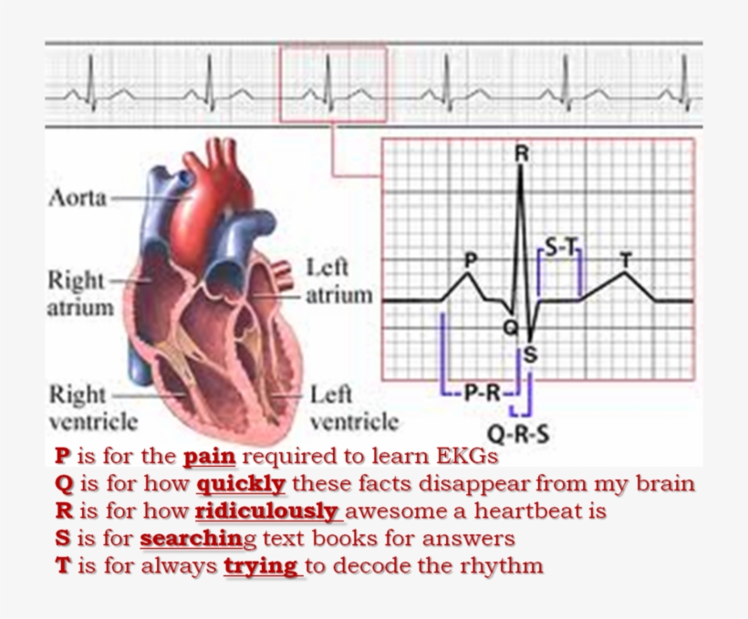 24hr Holter Monitor - 12 Lead Ekg: The Flash Card Book [book], transparent png #691215