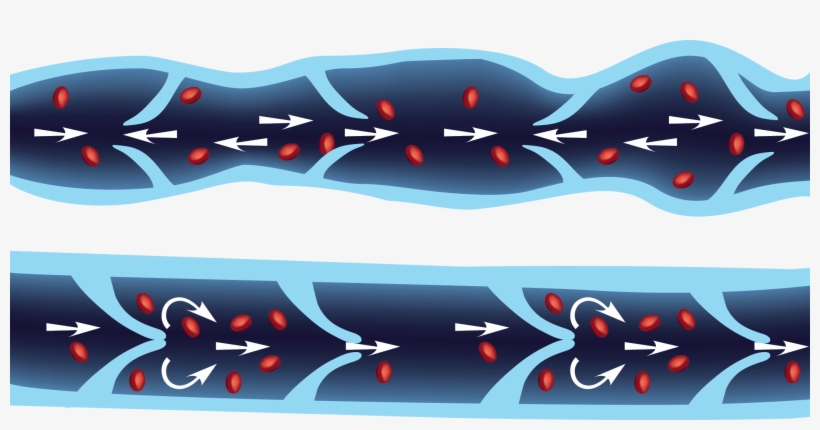 Varicose Veins By A Different Name - Vein, transparent png #696191
