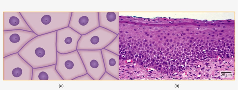 Illustration A Shows Irregularly Shaped Cells With, transparent png #6905093