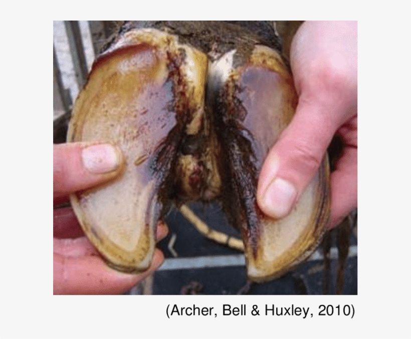 An Acute Bacterial Infection Of The Subcutaneous Tissues, transparent png #6909219