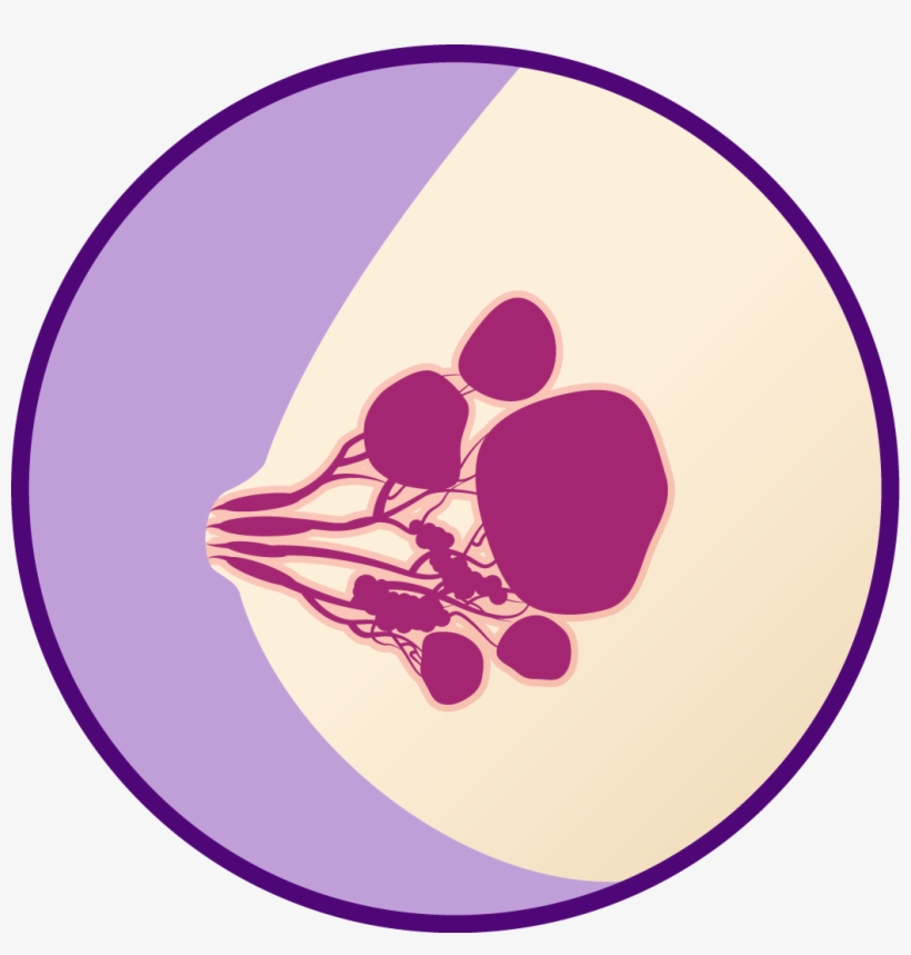 Normal Fibrocystic, transparent png #6932301