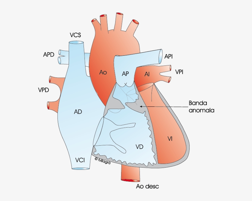 1 - 3 - 26 - -doblecamaravd - A -, transparent png #6942657