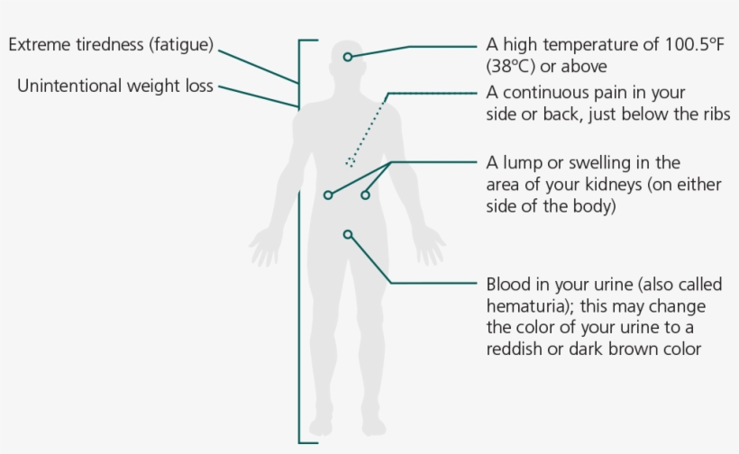 Signs & Symptoms, transparent png #6969812