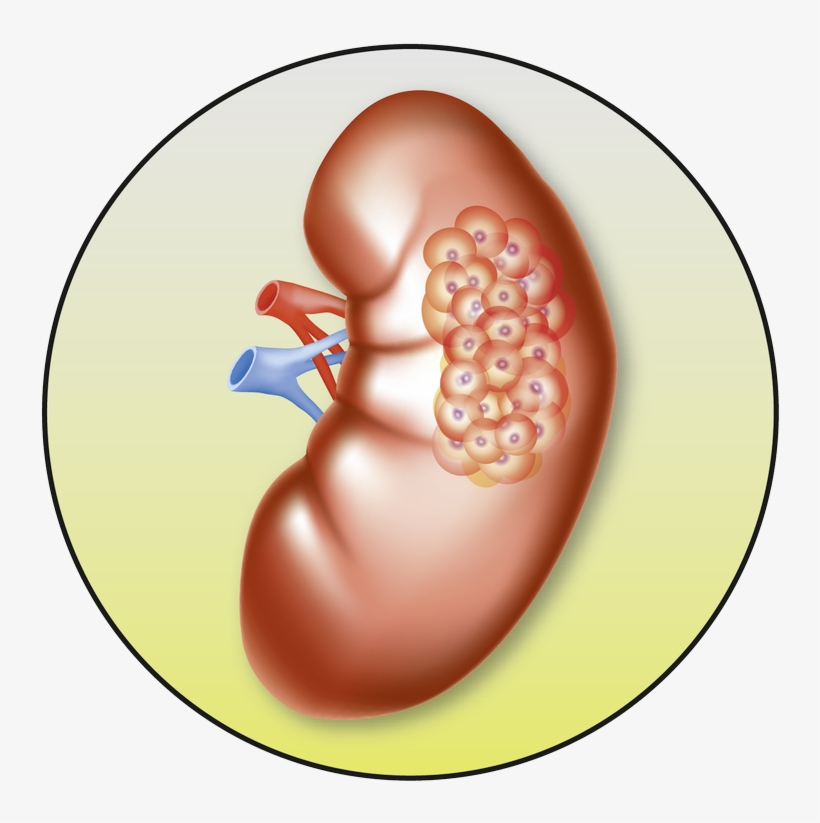 Understanding Therapy Options In, transparent png #6969867