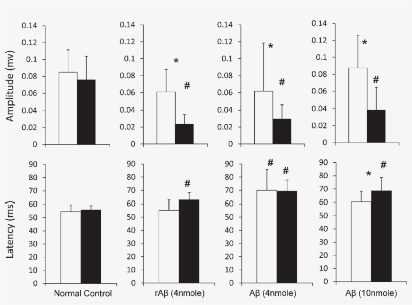 Vep Amplitude And Latency Of Left And Right Eyes (black, transparent png #6980471