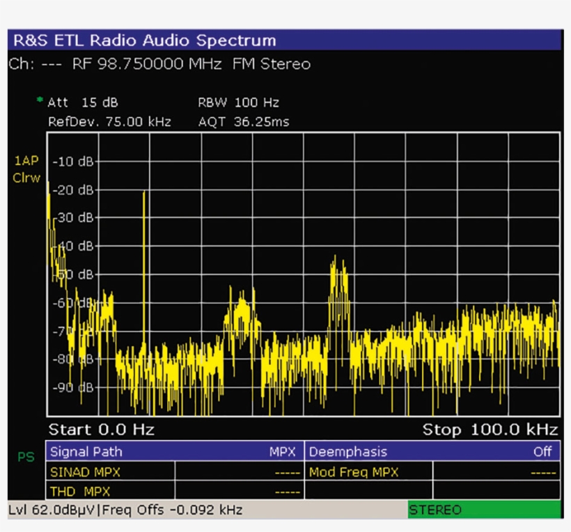 Etl Tv Analyzer, transparent png #6985766