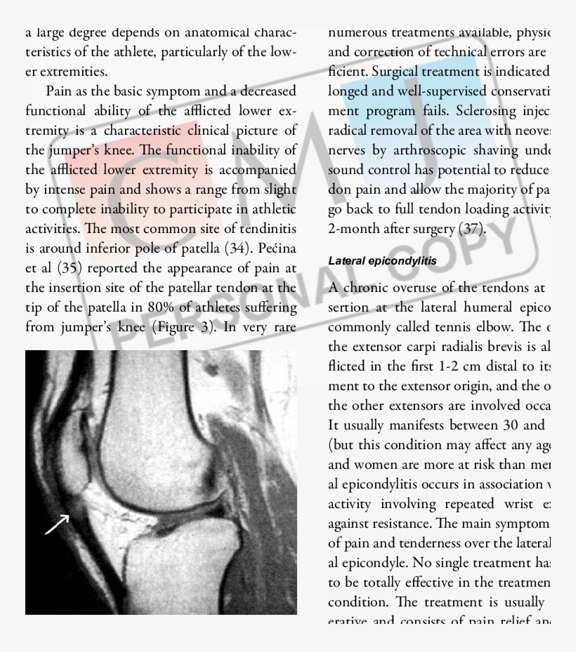 Magnetic Resonance Image Of The Female Volleyball Player - Document, transparent png #702483