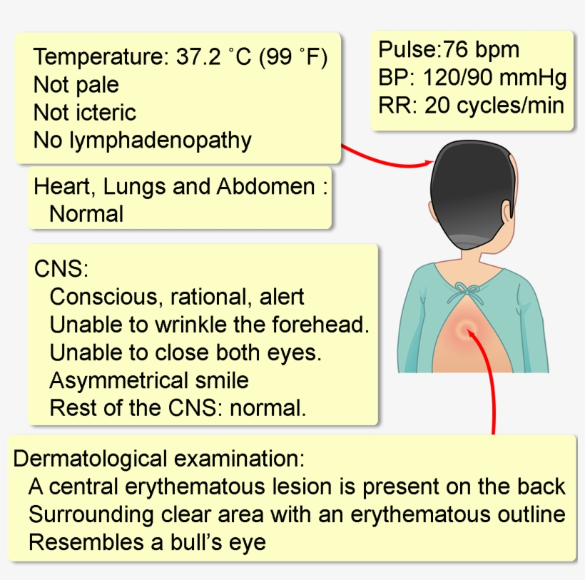 His Medical, Surgical And Family Histories Are Unremarkable, transparent png #7067167