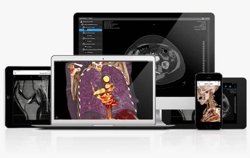 Resolutionmd On Devices, transparent png #7090531