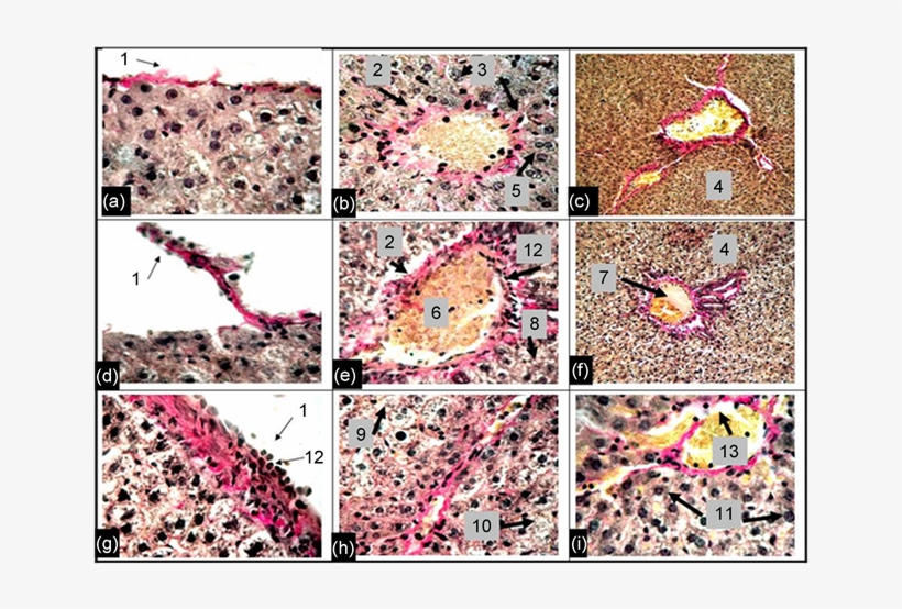 Photomicrographs Liver Preparations Control (c)) And, transparent png #7094678