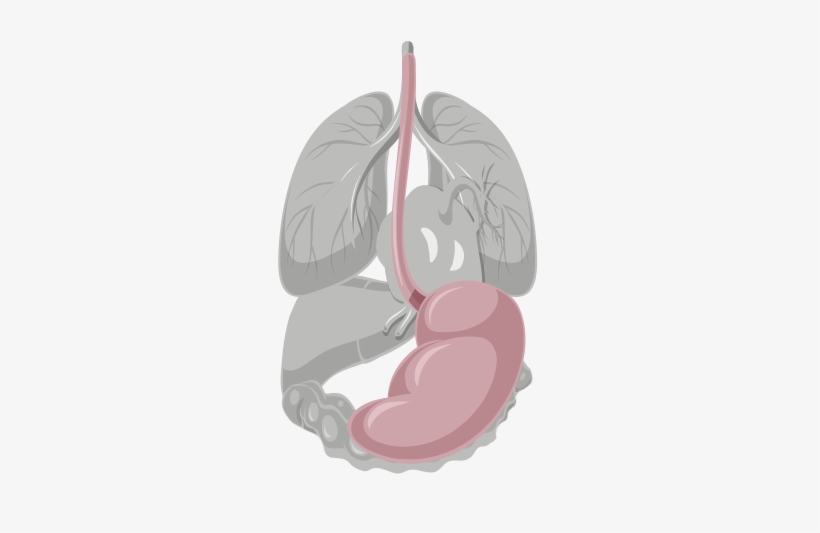 Stomach Cancer, Or Gastric Cancer, Is Due To An Abnormal - Illustration, transparent png #710447