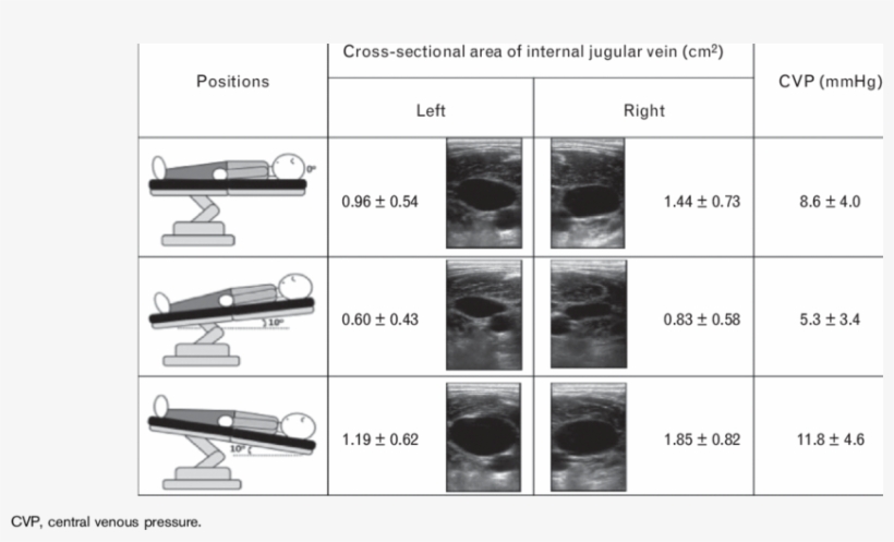 Cross-sectional Area Of Left And Right Internal Jugular, transparent png #7114813