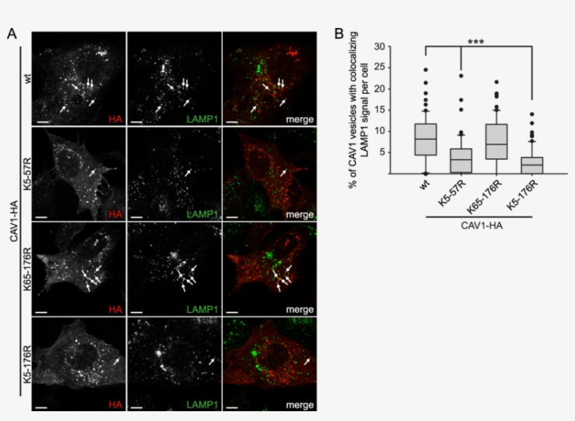 Ubiquitination Of Cav1 In The N-terminal Region Is, transparent png #7141886